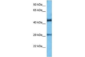 Image no. 3 for anti-Ets Variant 6 (ETV6) (C-Term) antibody (ABIN2792592)