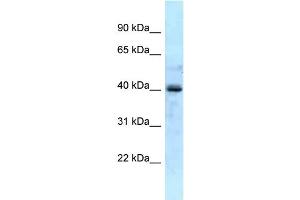 Image no. 1 for anti-Galactokinase 1 (GALK1) (N-Term) antibody (ABIN2788955)