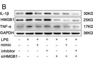 Image no. 4 for anti-Interleukin 1, beta (IL1B) antibody (ABIN3021462)