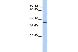 Image no. 1 for anti-Polymerase (RNA) III (DNA Directed) Polypeptide F, 39 KDa (POLR3F) (N-Term) antibody (ABIN2783471)