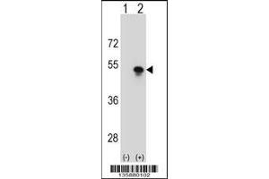 Image no. 2 for anti-Small Nuclear RNA Activating Complex, Polypeptide 1, 43kDa (SNAPC1) (AA 139-168) antibody (ABIN5537362)