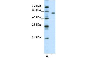 Image no. 2 for anti-Pre-B-Cell Leukemia Homeobox Protein 2 (PBX2) (C-Term) antibody (ABIN2780441)