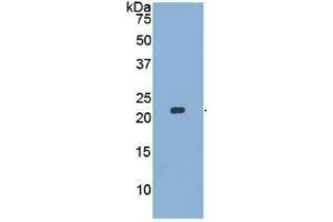 Image no. 2 for Matrix Metallopeptidase 13 (Collagenase 3) (MMP13) ELISA Kit (ABIN6730928)