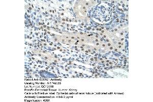 Image no. 3 for anti-Semenogelin I (SEMG1) (N-Term) antibody (ABIN2777136)
