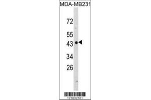 Image no. 1 for anti-N-Myc Downstream Regulated 1 (NDRG1) (AA 12-40), (N-Term) antibody (ABIN390922)
