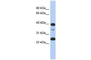Image no. 1 for anti-Thymopoietin (TMPO) (N-Term) antibody (ABIN634870)