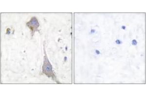 Image no. 2 for anti-Glutamate Receptor, Metabotropic 7 (GRM7) (AA 866-915) antibody (ABIN1533292)