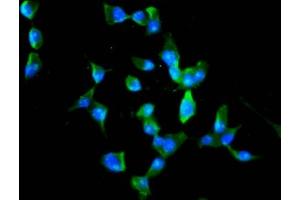Immunofluorescence staining of SH-SY5Y cells with ABIN7168374 at 1:100, counter-stained with DAPI.