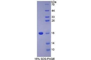 Image no. 1 for Phospholipase A2, Group IIA (Platelets, Synovial Fluid) (PLA2G2A) (AA 21-144) protein (His tag) (ABIN1878604)