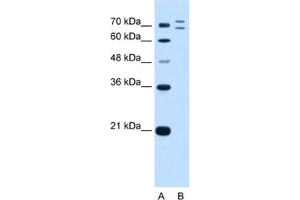 Image no. 1 for anti-Ring Finger Protein 168 (RNF168) antibody (ABIN2462696)