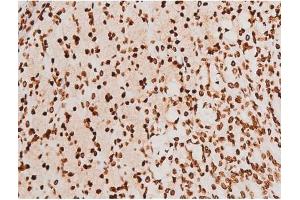 Image no. 3 for anti-Spleen tyrosine Kinase (SYK) (pTyr348) antibody (ABIN6255895)