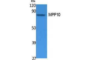 anti-M-Phase phosphoprotein 10 (U3 Small Nucleolar Ribonucleoprotein) (MPHOSPH10) (Internal Region) antibody