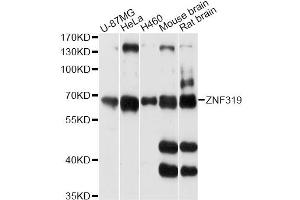 Image no. 1 for anti-Zinc Finger Protein 319 (ZNF319) antibody (ABIN6293846)