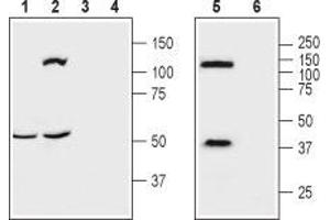 Western blot analysis of mouse brain (lanes 1 and 3), rat brain (lanes 2 and 4) and human brain neuroblastoma (SH-SY5Y) cell (lanes 5 and 6) lysates: - 1,2,5.