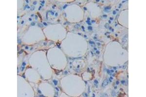 Image no. 2 for anti-Myosin, Heavy Chain 7B, Cardiac Muscle, beta (MYH7B) (AA 829-1106) antibody (ABIN1869362)