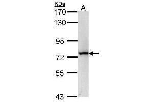 Image no. 1 for anti-RecQ Protein-Like (DNA Helicase Q1-Like) (RECQL) (C-Term) antibody (ABIN2857057)