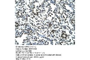 Image no. 2 for anti-Sirtuin 5 (SIRT5) (Middle Region) antibody (ABIN2779613)