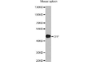 Image no. 3 for anti-Complement Factor P (CFP) antibody (ABIN1876586)