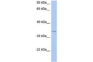 Image no. 1 for anti-N-Ethylmaleimide Sensitive Fusion Protein Attachment Protein beta (NAPB) (N-Term) antibody (ABIN2792291)