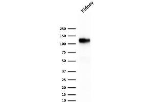 Image no. 1 for anti-Cadherin-16 (CDH16) antibody (ABIN6939021)