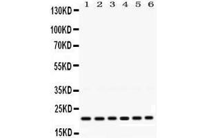 Image no. 1 for anti-RAB10, Member RAS Oncogene Family (RAB10) (AA 153-185), (C-Term) antibody (ABIN3043448)