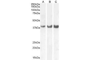 Image no. 1 for anti-Homeobox D13 (HOXD13) (Internal Region) antibody (ABIN6391407)