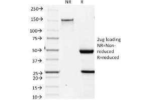 Image no. 4 for anti-Keratin 19 (KRT19) antibody (ABIN6939943)