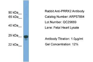 Image no. 1 for anti-Paired Related Homeobox 2 (PRRX2) (Middle Region) antibody (ABIN2787441)