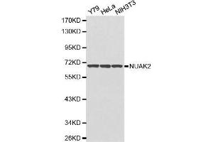 Image no. 1 for anti-NUAK Family, SNF1-Like Kinase, 2 (NUAK2) antibody (ABIN3021383)