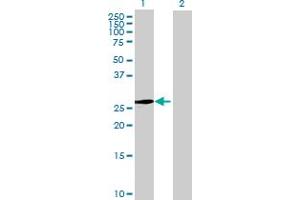 Image no. 1 for anti-Ankyrin Repeat and SOCS Box Containing 9 (ASB9) (AA 1-294) antibody (ABIN530780)