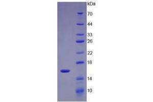 Image no. 1 for UDP-Glucose Ceramide Glucosyltransferase (UGCG) (AA 39-171) protein (His tag) (ABIN6237954)