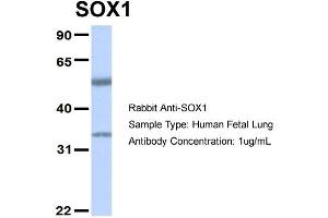 Image no. 4 for anti-SRY (Sex Determining Region Y)-Box 1 (SOX1) (Middle Region) antibody (ABIN2777427)