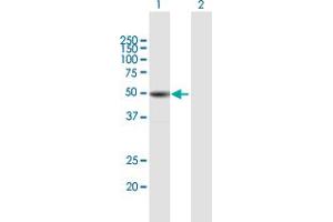 Western Blot analysis of TUBB1 expression in transfected 293T cell line by TUBB1 MaxPab polyclonal antibody.