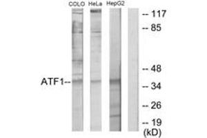 Image no. 2 for anti-Activating Transcription Factor 1 (AFT1) (AA 176-225) antibody (ABIN1533644)
