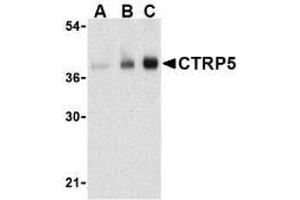 Image no. 1 for anti-C1q and Tumor Necrosis Factor Related Protein 5 (C1QTNF5) (N-Term) antibody (ABIN499673)