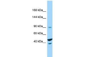 Image no. 1 for anti-Tripartite Motif Containing 71, E3 Ubiquitin Protein Ligase (TRIM71) (C-Term) antibody (ABIN2790878)