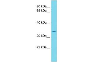 Image no. 1 for anti-Mast Cell Immunoglobulin-Like Receptor 1 (MILR1) (C-Term) antibody (ABIN2774533)