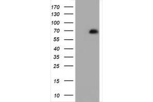 Image no. 7 for anti-Zinc Finger and SCAN Domain Containing 18 (ZSCAN18) antibody (ABIN1501861)