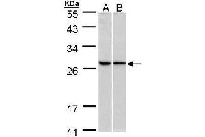 Image no. 2 for anti-Ribosomal Protein L13a (RPL13A) (Center) antibody (ABIN2855333)