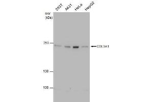 COL3A1 antibody  (C-Term)