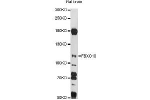 Image no. 1 for anti-F-Box Protein 10 (FBXO10) antibody (ABIN6292076)
