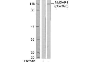 Image no. 1 for anti-NMDA Receptor 1 (NMDA R1) (pSer896) antibody (ABIN196794)