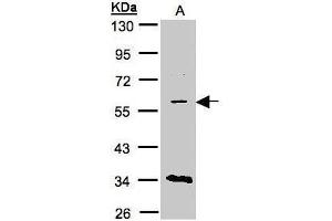Image no. 1 for anti-Solute Carrier Family 7 (Cationic Amino Acid Transporter, Y+ System), Member 1 (SLC7A1) (Center) antibody (ABIN2855533)