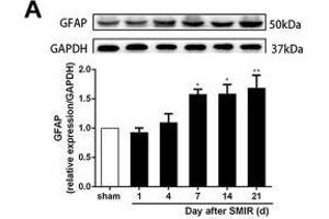 Image no. 24 for anti-Glyceraldehyde-3-Phosphate Dehydrogenase (GAPDH) antibody (ABIN3020541)