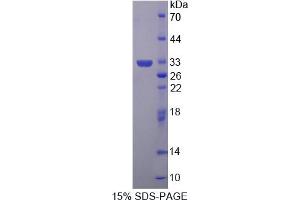 Image no. 1 for Glutaredoxin 3 (GLRX3) (AA 73-320) protein (His tag) (ABIN6238070)
