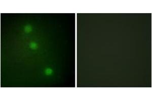 Image no. 1 for anti-Activating Transcription Factor 1 (AFT1) (AA 176-225) antibody (ABIN1533644)
