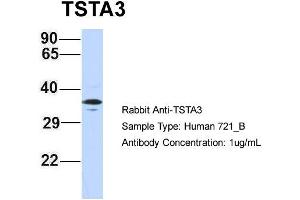 Image no. 1 for anti-Tissue Specific Transplantation Antigen P35B (TSTA3) (N-Term) antibody (ABIN2787788)