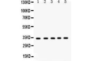 Image no. 5 for anti-Estrogen Receptor Binding Site Associated, Antigen, 9 (EBAG9) (AA 31-213) antibody (ABIN3043569)