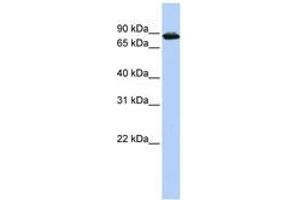 Image no. 1 for anti-HIV-1 Tat Specific Factor 1 (HTATSF1) (AA 612-661) antibody (ABIN6744230)