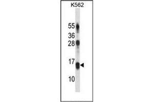 Western blot analysis of LY86 / MD-1 Antibody (C-term) in K562 cell line lysates (35ug/lane).